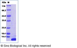Sino Biological Mouse C5a / Complement 5a Protein 100ug, Quantity: Each