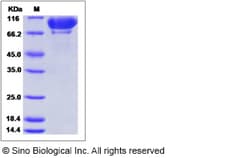 Sino Biological Recombinant Mouse Complement C2 Protein (His Tag), HPLC-verified,
