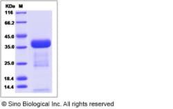 Sino Biological Recombinant Mouse CNPY3 Protein (His Tag), Quantity: Each