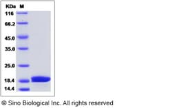 Sino Biological Recombinant Mouse Reg2 Protein (His Tag), Quantity: Each