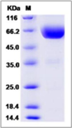 Sino Biological Mouse TIM3 / HAVCR2 Protein (Fc Tag) 100ug, Quantity: Each