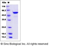 Sino Biological Recombinant Hamster FUT8 Protein (aa 68-575, His Tag),