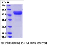 Sino Biological Recombinant Mouse Tnfrsf26 Protein (hFc Tag), Quantity:
