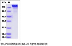 Sino Biological Recombinant Mouse CHL-1/L1CAM-2 Protein (His Tag) 500,