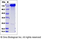 Sino Biological Recombinant Mouse CHL-1/L1CAM-2 Protein, Quantity: Each