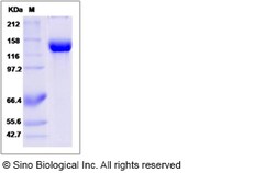 Sino Biological Recombinant Mouse Siglec-2/CD22 Protein (hFc Tag), HPLC-verified,