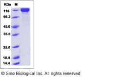 Sino Biological Recombinant Mouse Siglec-2/CD22 Protein (His Tag), HPLC-verified,