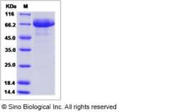 Sino Biological Recombinant Mouse EGF-L6 Protein (hFc Tag), Quantity: Each
