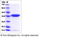 Sino Biological Recombinant Mouse LDHA Protein (His Tag), Quantity: Each