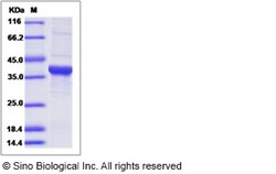 Sino Biological Recombinant Mouse GAPDH Protein (His Tag), Quantity: Each