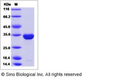 Sino Biological Recombinant Mouse SBDS Protein (His Tag), Quantity: Each