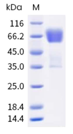 Sino Biological Mouse IL15RA Protein (ECD, Fc Tag) 100µg, Quantity: Each