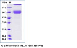 Sino Biological Recombinant Mouse IL-10RA/IL-10R alpha Protein (ECD, hFc