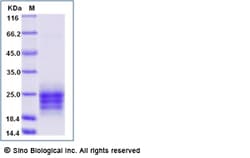 Sino Biological Recombinant Mouse IL-9 Protein (His Tag) 500, Quantity: