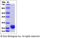 Sino Biological Recombinant Human Carboxypeptidase M Protein (His Tag),