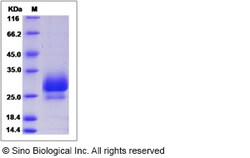 Sino Biological Recombinant Mouse IL-28A/Interferon lambda-2 Protein (His