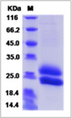 Sino Biological Recombinant Mouse IL-28B/Interferon lambda-3 Protein (His