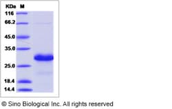 Sino Biological Recombinant Mouse HN1 Protein (His Tag), Quantity: Each