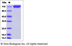 Sino Biological Recombinant Mouse MAG/Siglec-4a Protein (ECD, hFc Tag),