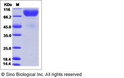 Sino Biological Recombinant Mouse MAG/Siglec-4a Protein (His Tag), HPLC-verified,