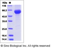 Sino Biological Recombinant Mouse PLA2G7/PAF-AH Protein (His Tag), Quantity: