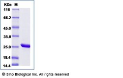 Sino Biological Recombinant Mouse Peroxiredoxin 2 Protein (His Tag), Quantity: