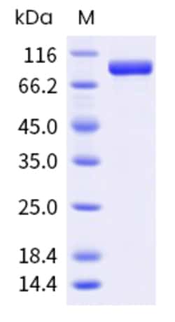 Sino Biological Mouse HSP90AA1 Protein 1MG (Sino Biological), Quantity: