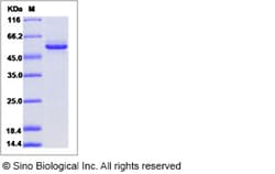 Sino Biological Recombinant Mouse GFOD2 Protein (His Tag), Quantity: Each
