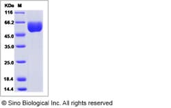 Sino Biological Recombinant Mouse SMPDL3A Protein (His Tag), Quantity: