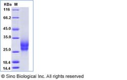 Sino Biological Recombinant Mouse PIK3IP1 Protein (His Tag), Quantity: