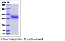 Sino Biological Mouse MMP-2 / MMP2 Protein (His Tag) 100ug, Quantity: Each