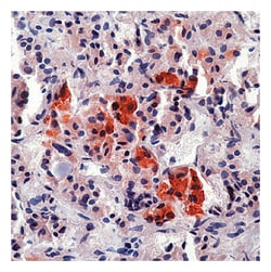 Epredia&trade;&nbsp;Richard-Allan Mouse Monoclonal Antibodies ACTH-CD45/LCA