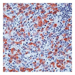 Epredia&trade;&nbsp;Richard-Allan Mouse Monoclonal Antibodies ACTH-CD45/LCA