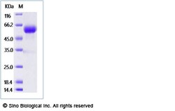 Sino Biological Mouse LAG3 / CD223 / Lymphocyte activation gene 3 Protein