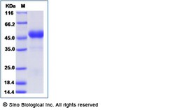 Sino Biological Recombinant Mouse OX40 Ligand/TNFSF4 Protein (rFc Tag),