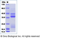 Sino Biological Recombinant Mouse RGMB Protein (His Tag), HPLC-verified,