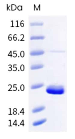 Sino Biological Mouse NR1H4 Protein 500ug (Sino Biological), Quantity: