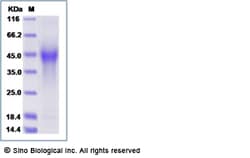 Sino Biological Recombinant Mouse CD44 Protein (His Tag), Quantity: Each