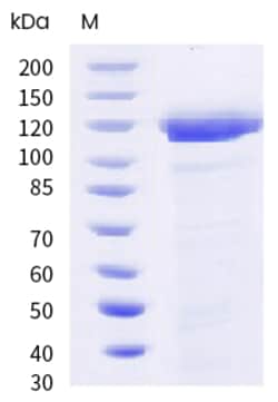 Sino Biological Mouse CEACAM5 Protein 100ug (Sino Biological), Quantity:
