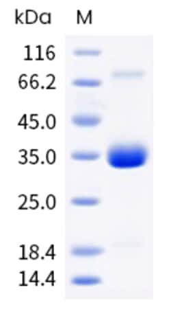 Sino Biological Mouse KLK15 Protein 100ug (Sino Biological), Quantity: