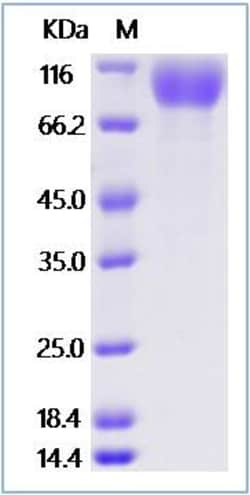 Sino Biological Recombinant Mouse PDGF alpha receptor/PDGFRA Protein (ECD,