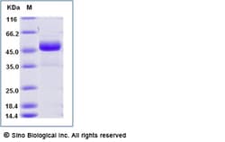 Sino Biological Mouse NKG2D / CD314 Protein (Fc Tag) 100ug, Quantity: Each