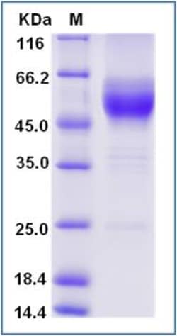 Sino Biological Mouse GITR / TNFRSF18 Protein (Fc Tag) 100ug, Quantity: