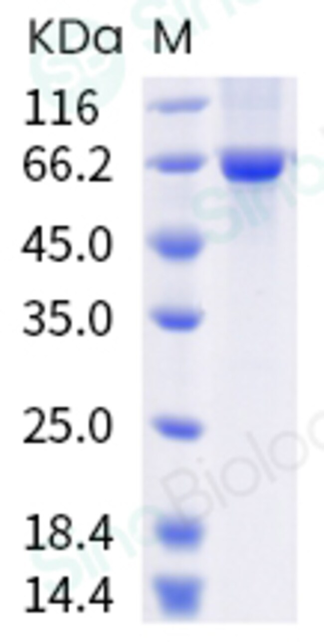 Sino Biological HSP70 Protein, Mouse, (His Tag) 100g