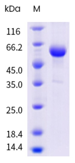 Sino Biological&nbsp;Recombinant Mouse SOST/Sclerostin Protein (hFc Tag), HPLC-verified 100 µg