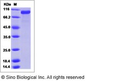 Sino Biological Recombinant Mouse GAS6 Protein (His Tag), HPLC-verified,
