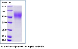 Sino Biological Recombinant Mouse CD30/TNFRSF8 Protein (ECD, His Tag),