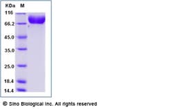 Sino Biological Recombinant Mouse Nectin-1/PVRL1 Protein (ECD, hFc Tag),
