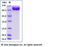 Sino Biological Recombinant Mouse Nectin-1/PVRL1 Protein (ECD, hFc Tag),
