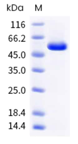 Sino Biological Mouse ALDH1A3 Protein (His Tag) 50µg, Quantity: Each of